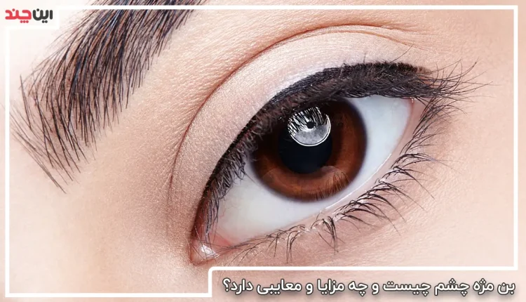 بن مژه چشم چیست ؟ آشنایی با مزایا و معایب بن مژه